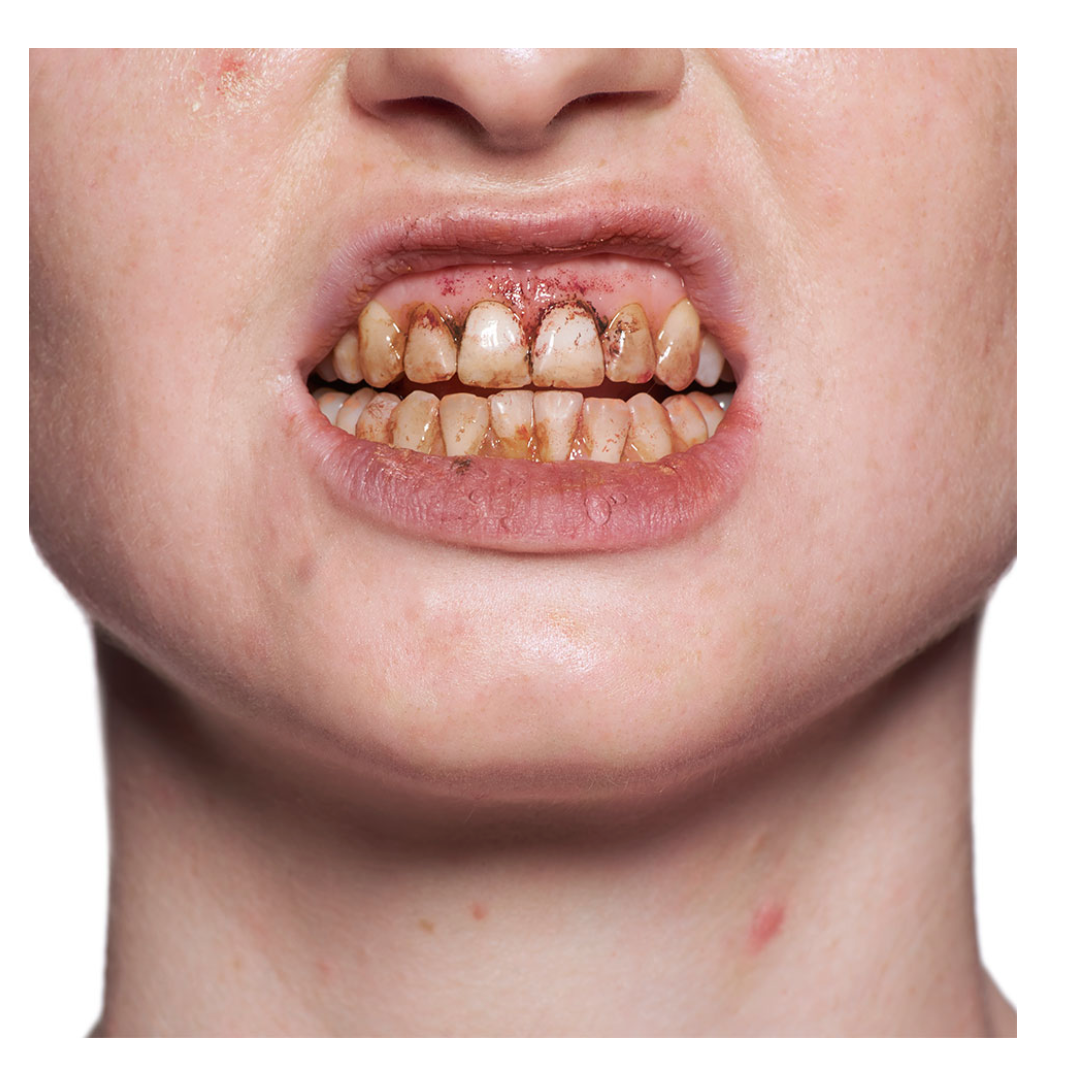 Kryolan Tooth Enamel