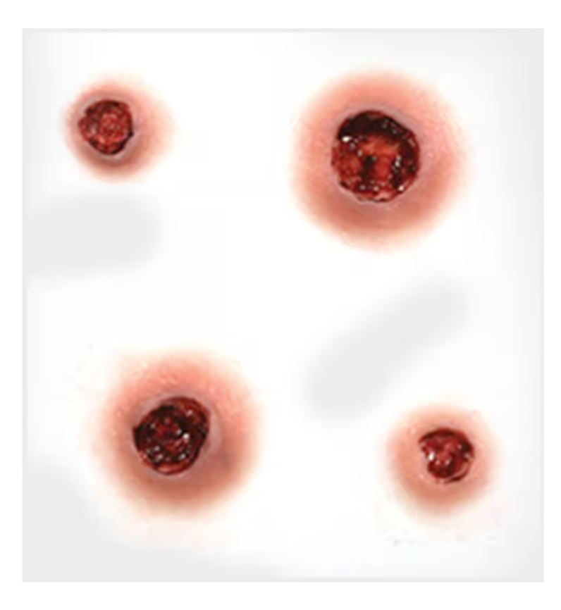 TINSLEY TRANSFERS 3D FX Transfers – Capped