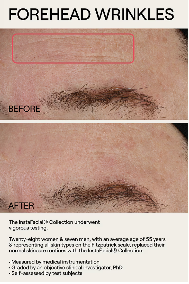 Dr. Diamond's Metacine InstaFacial Plasma Bioactive Growth Factor Serum