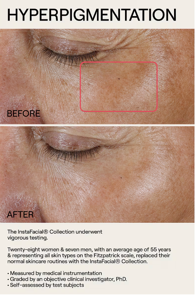 Dr. Diamond's Metacine InstaFacial Plasma Bioactive Growth Factor Serum