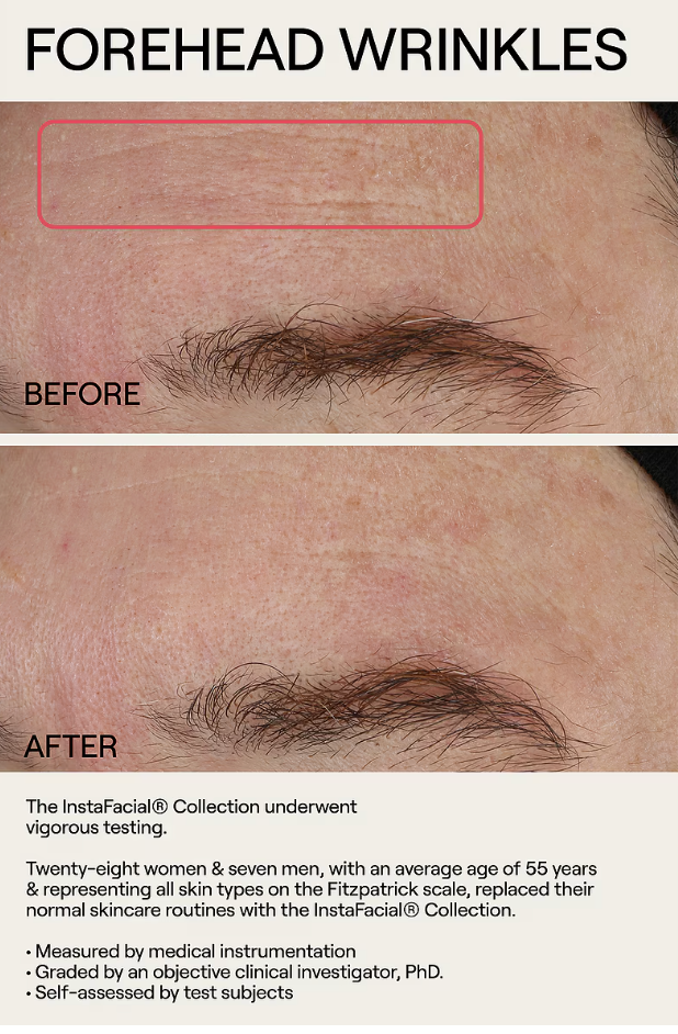 Dr. Diamond's Metacine InstaFacial Emulsion Retinopro Growth Factor Night Cream