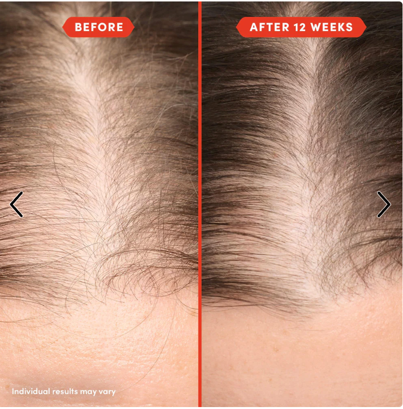 Fable & Mane HoliRoots Pre-Wash Scalp & Hair Treatment Oil ( sold per piece)