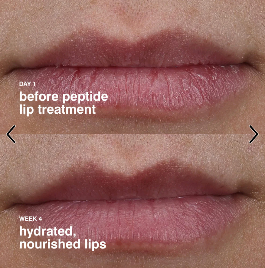 Rhode Peptide Lip Treatment Nourishing Glaze - Strawberry