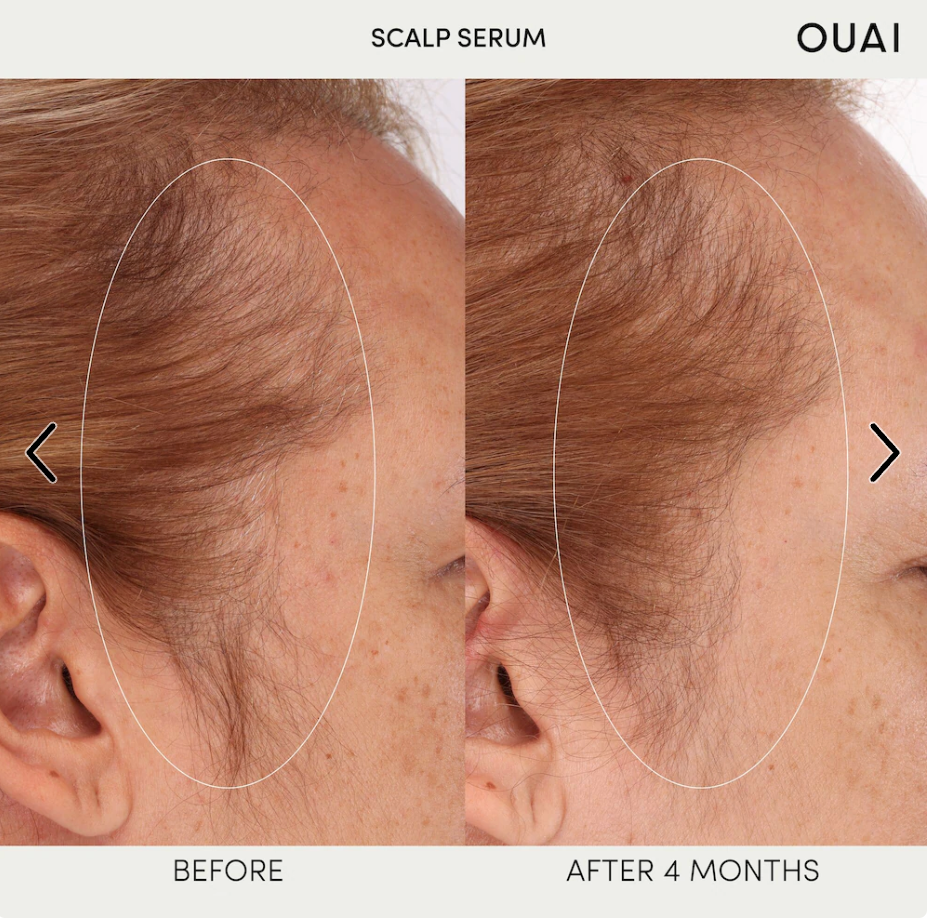 OUAI  Hydrating Scalp Serum for Healthy, Fuller Looking Hair