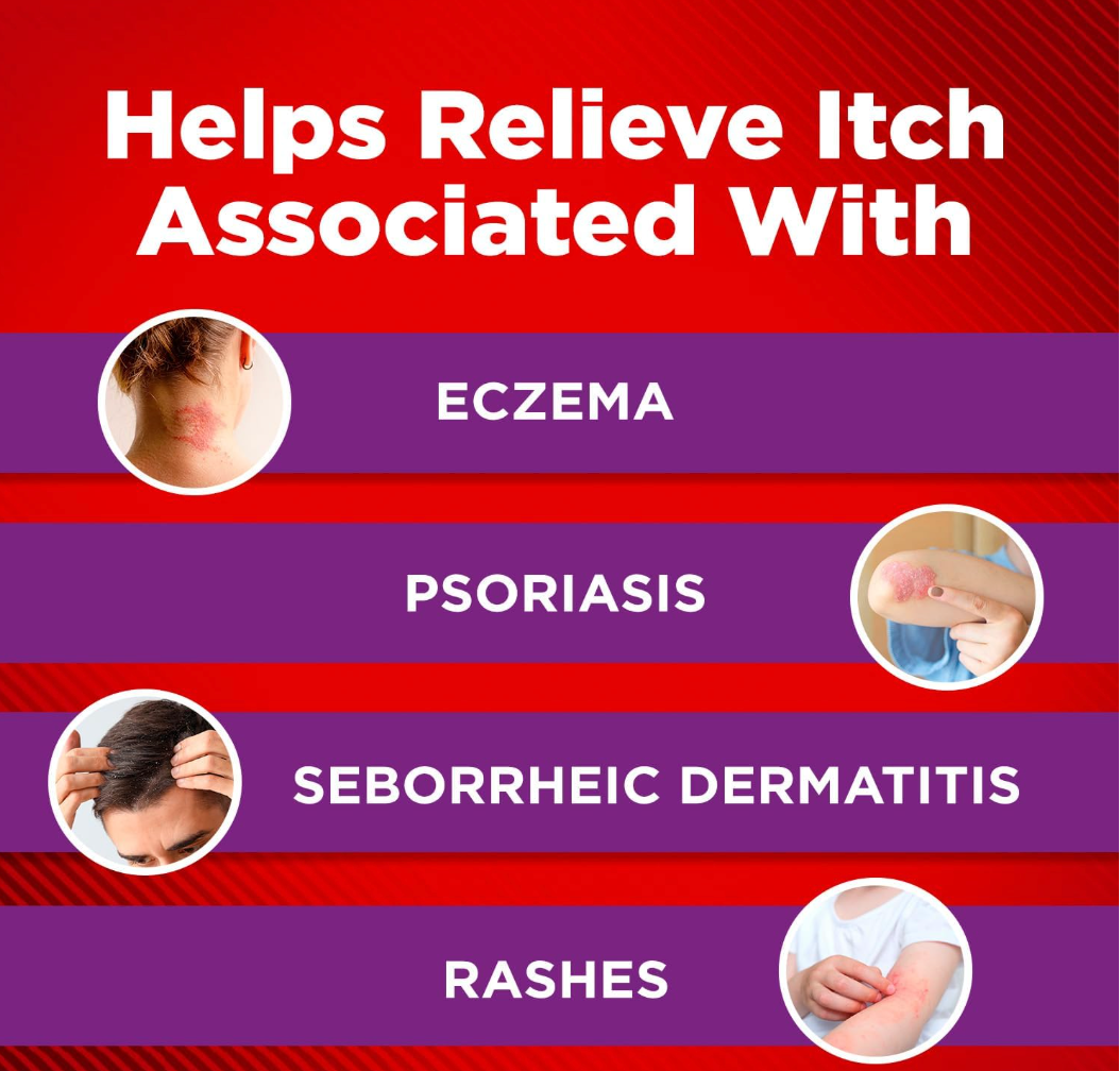 Cortizone-10 Maximum Strength Intensive Healing Itch Relief Lotion for Eczema, 1% - 3.5 oz